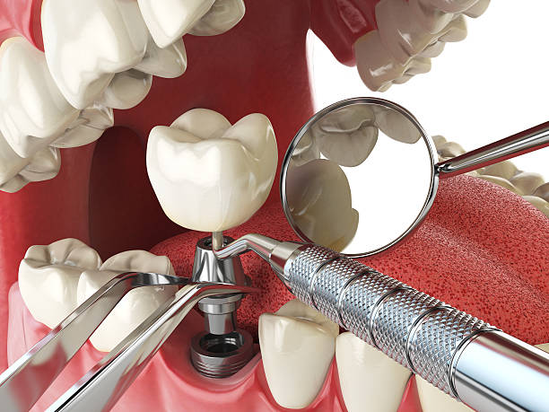 Best Orthodontic Emergency Dentist in Ridgewood, IL
